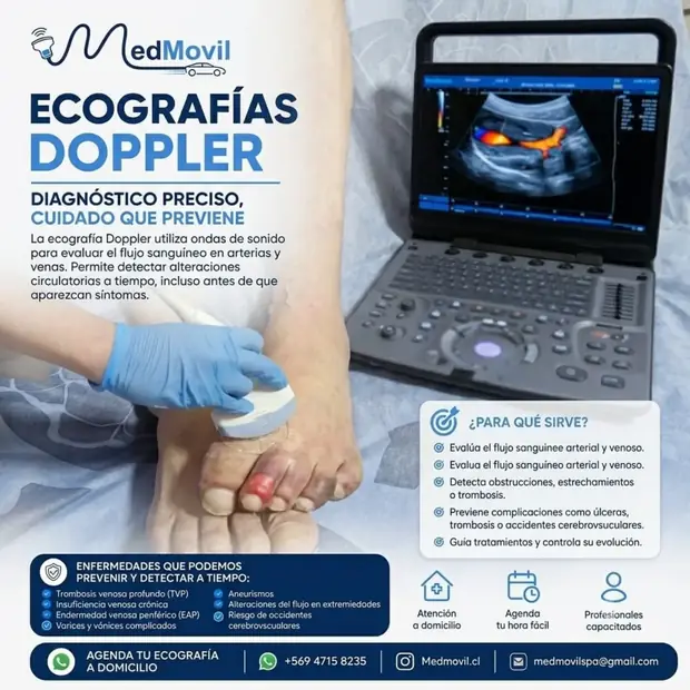 Doppler: qué detecta y por qué conviene a tiempo